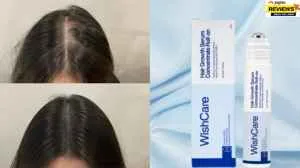 WishCare Hair Growth Serum Options For A Nourishment and Care Routine
                                          